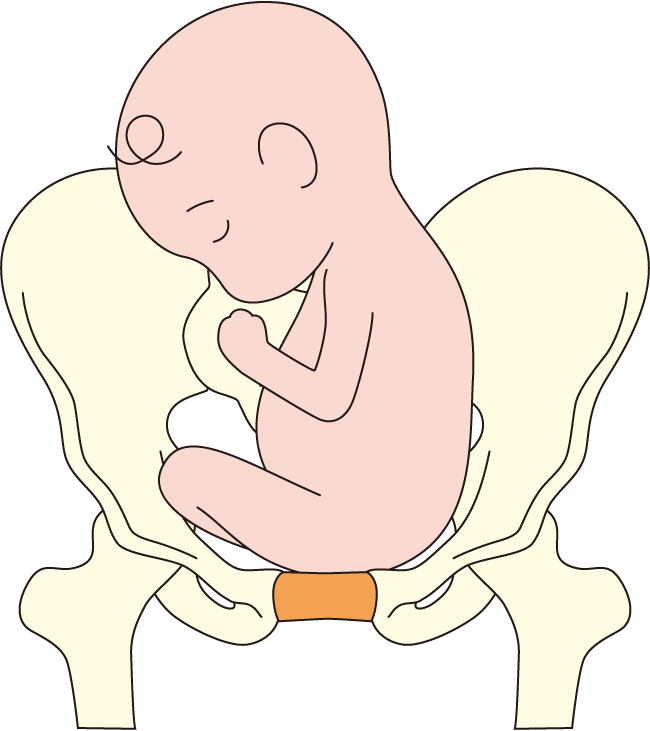 逆子 妊娠中 分娩時のゆるみ ゆがみの影響 骨盤ケア トコちゃんベルトの青葉 公式サイト